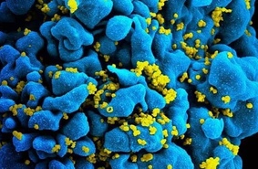Компьютерное моделирование успешно применили для терапии ВИЧ
