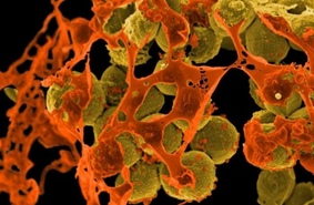 Новый полимер убивает микробы, но не человека