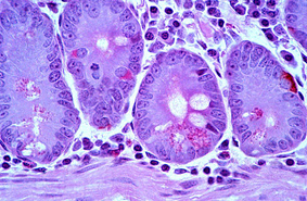 Почему так важны клетки Панета для здоровья кишечника  и иммунитета человека
