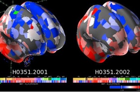 Создана новая карта головного мозга человека в высоком разрешении