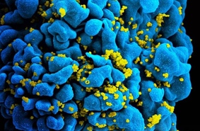 Ученые описали, как началась эпидемия ВИЧ в США