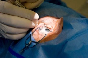 Японские ученые сумели восстановить зрение человека с помощью стволовых клеток его кожи