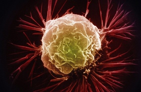 3D-микроскоп расскажет, как раковые клетки врастают в другие ткани