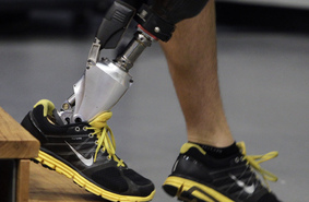 3D-протезы помогут вернуться к занятиям спортом