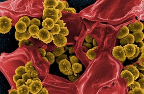 Химики научились вылавливать бактерий из крови магнитом