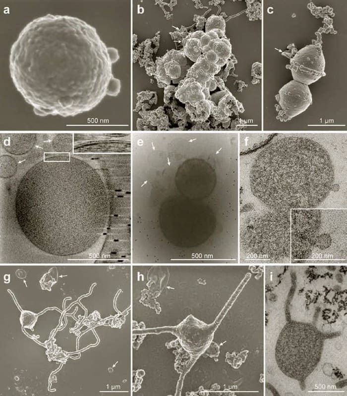колонии, клетки, исследование, микроскоп, микроорганизм