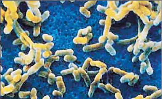Микроорганизмы, возбудитель чумы, Yersinia pestis 