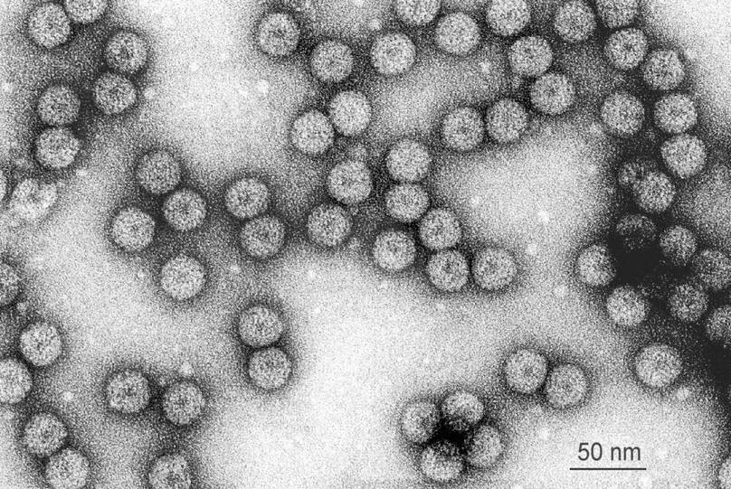 Микрофотография частиц вируса огуречной мозаики
