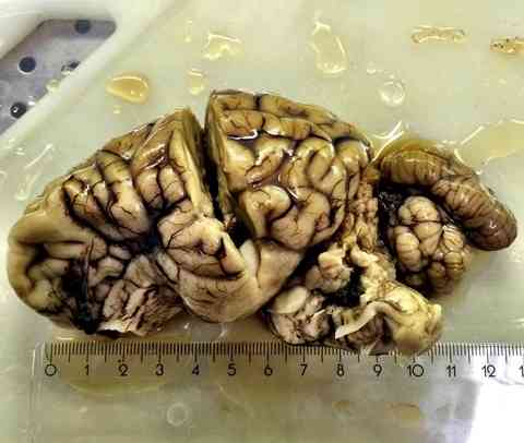 Мозг зараженного оленя