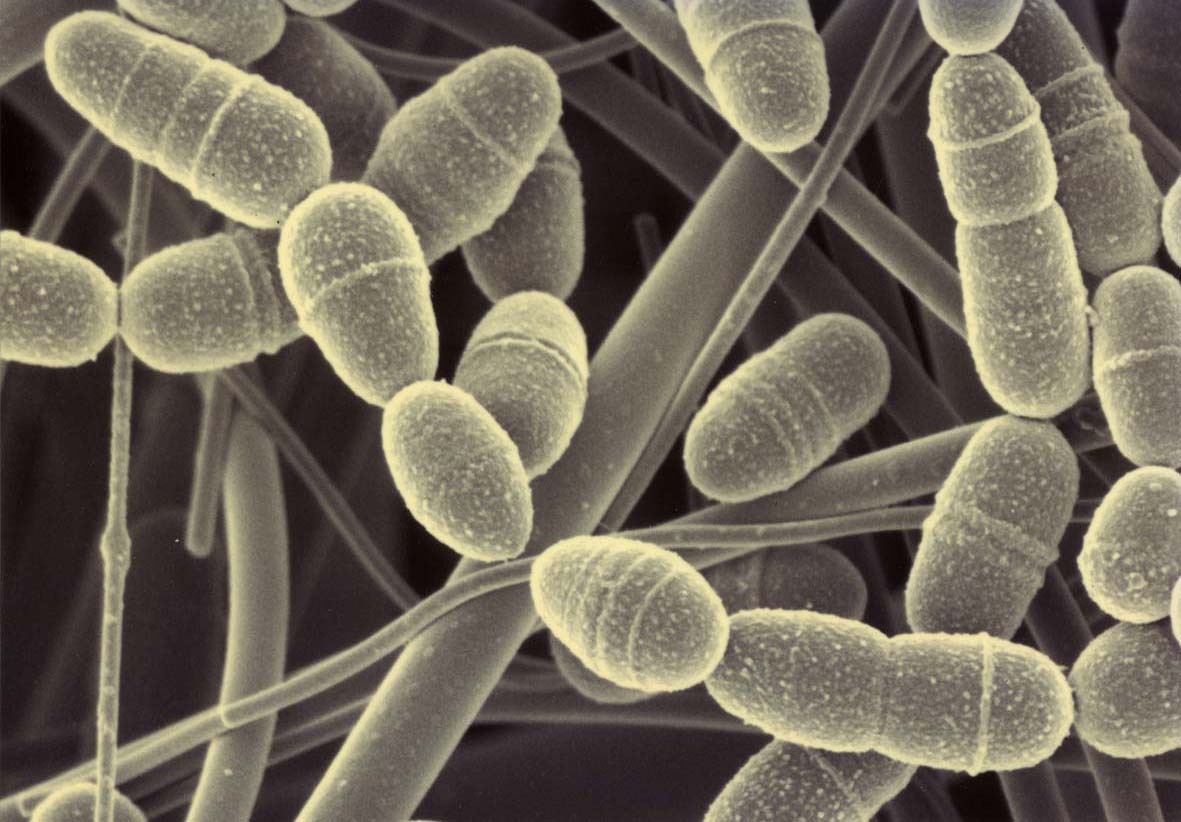 2.	Streptococcus mutans – патогенная бактерия, живущая в полости рта человека, которую смогли обезвредить наночастицы зеленого чая 