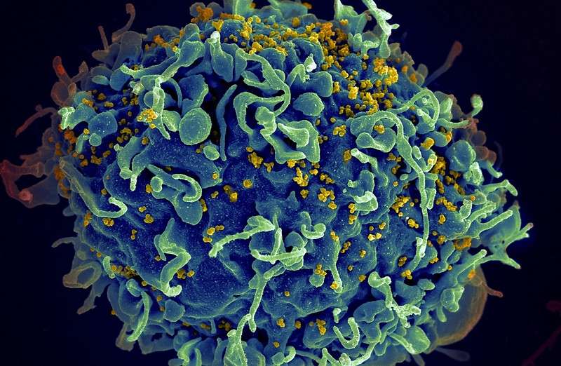 Клетка Т-лимфоцита, атакованная вирусом иммунодефицита человека