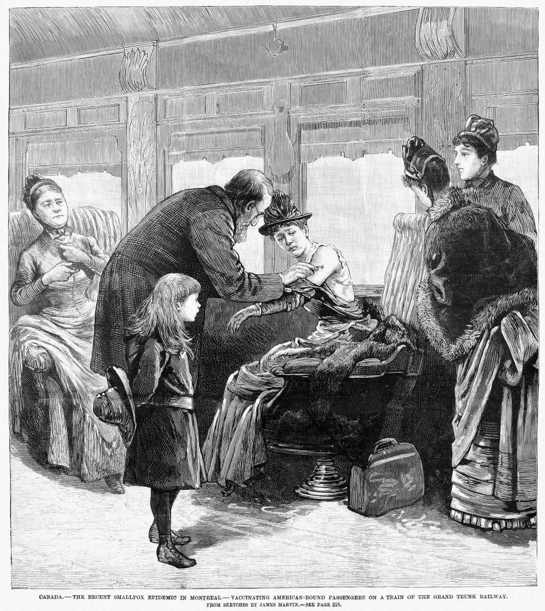 Вакцинация во время эпидемии оспы, вспыхнувшей в Монреале в 1885 году